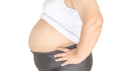 Obezite Ameliyatları Hormonal Nedenlerle Kilo Alanlar İçin Uygun Değil