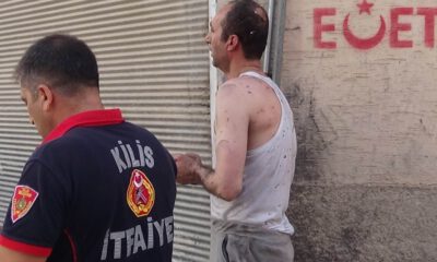 Kiliste Ev Yangını: 1 Yaralı