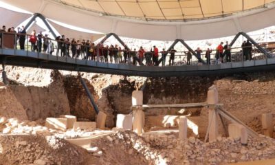Dünyanın İlk Ameliyatının Göbeklitepede Yapıldığı Ortaya Çıktı