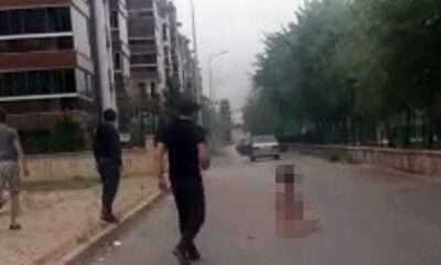 Sevgilisini Yakmadan Önce 79 Kez Aramış
