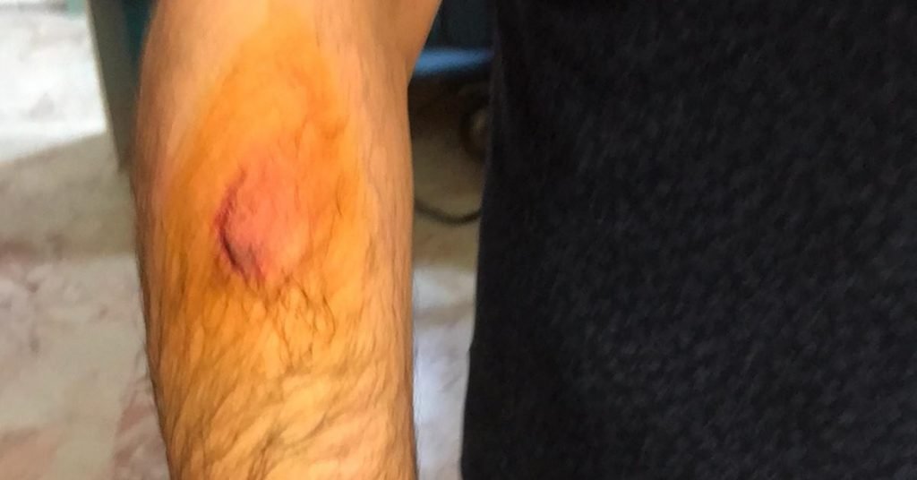 Hasta yakını, sağlık çalışanını böyle darp etti