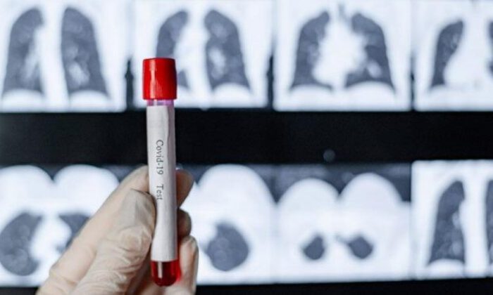 Koronavirüs tablosu açıklandı! 33 gün sonra ilk kez…