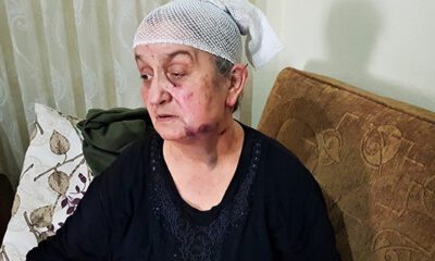 Ölü numarası yaparak kurtuldu
