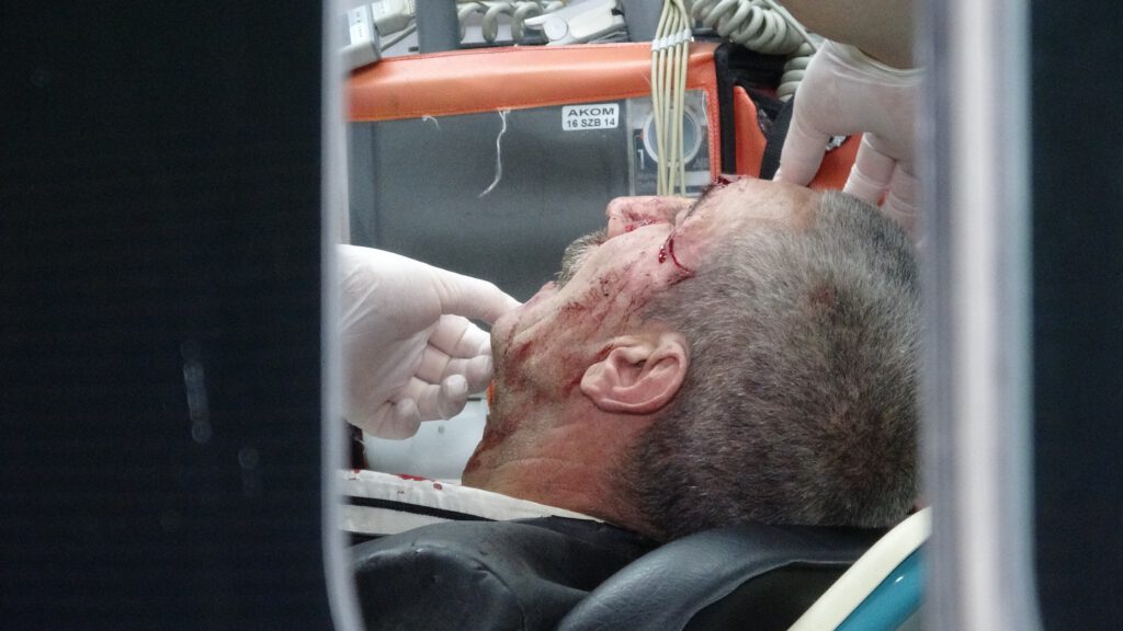 Engelli kardeşini bıçaklayıp başında sigara içti