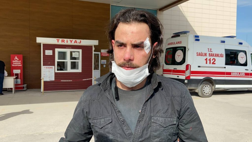 Hem suçlu hem güçlü! İşyeri sahibi, işçisini hastanelik etti!