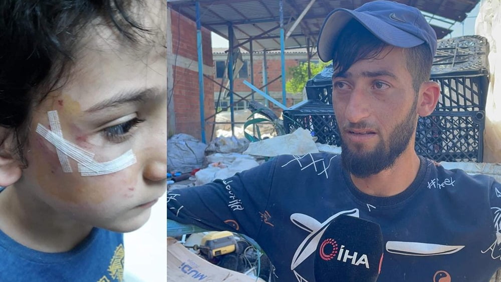 Küçük çocuk, sokak köpeğinden böyle kurtarıldı