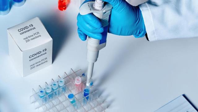 20 Ağustos corona virüs tablosu