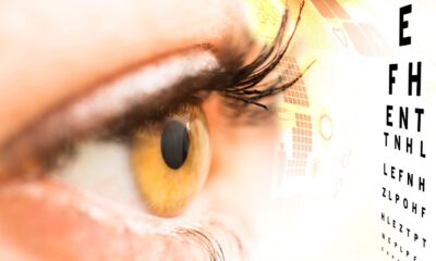 Astigmat nedir?