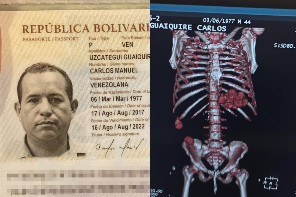 Midesinde kokain patlayan kurye havalimanında yakalandı