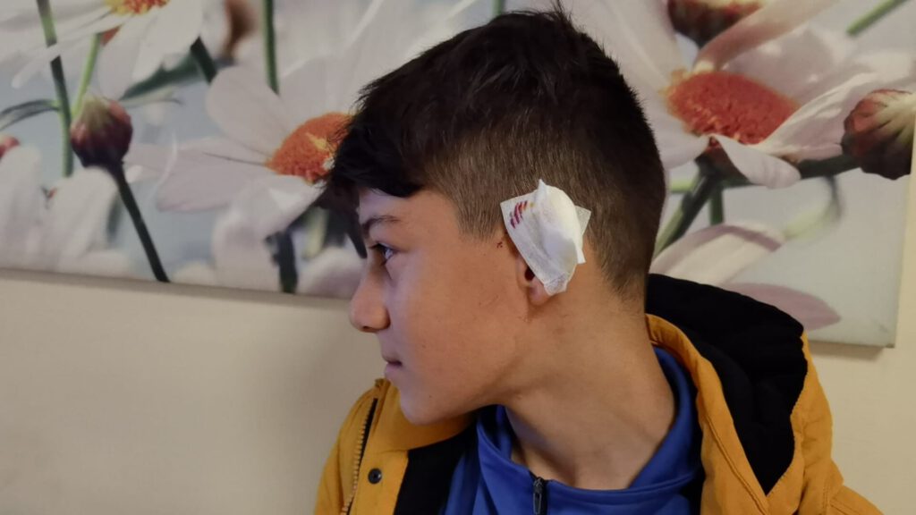 Bursa’da kartopu oynayan çocuğa köpek saldırdı