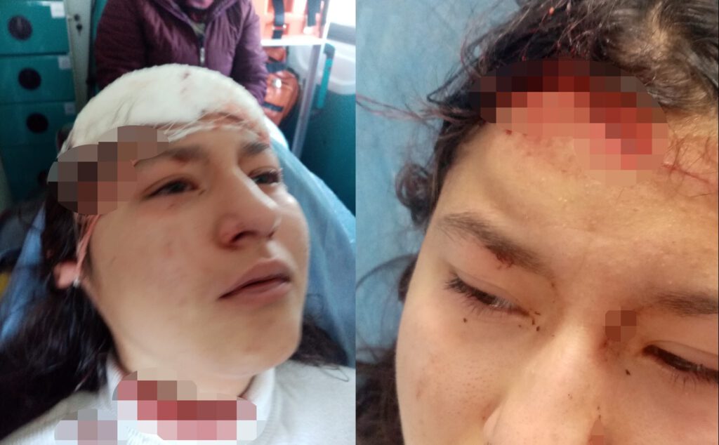 Korkunç olay! Sokak köpekleri genç kızı öldürüyordu