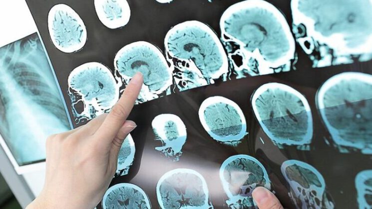 MS gençleri tehdit ediyor