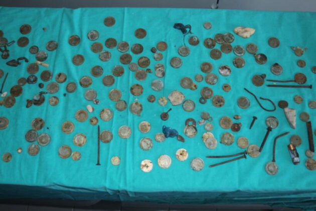 Van’da akıl almaz olay: Midesinden 83 TL madeni para çıktı