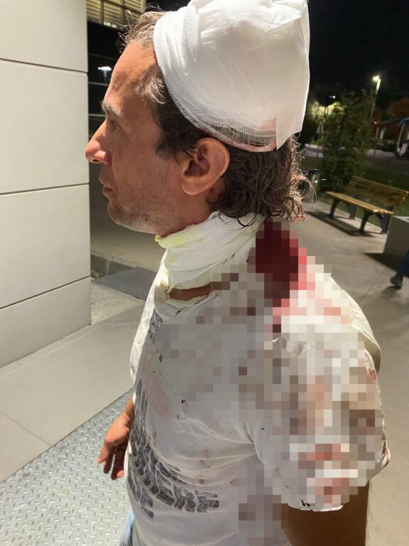 Önce ısırıp darp etti, sonra taksiyle kaldırıma çıkıp ağaca vurdu