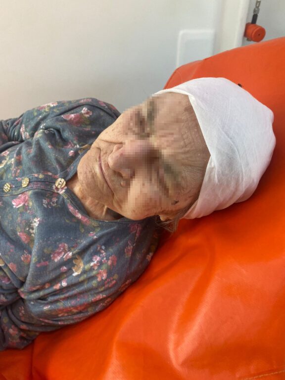 Madde bağımlısı genç, 85 yaşındaki anneannesini dövdü