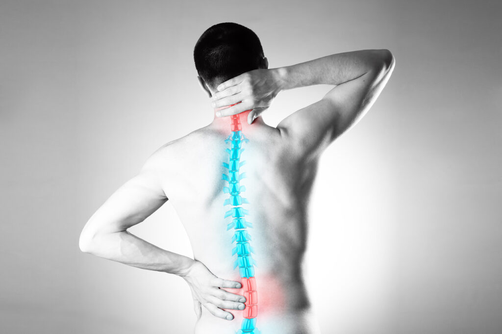 Skolyozda dikkat  edilmesi gerekenler