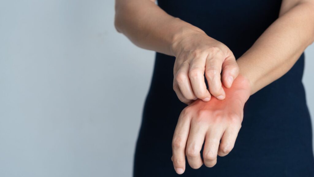 Uyuz vakaları 30-40 kat arttı