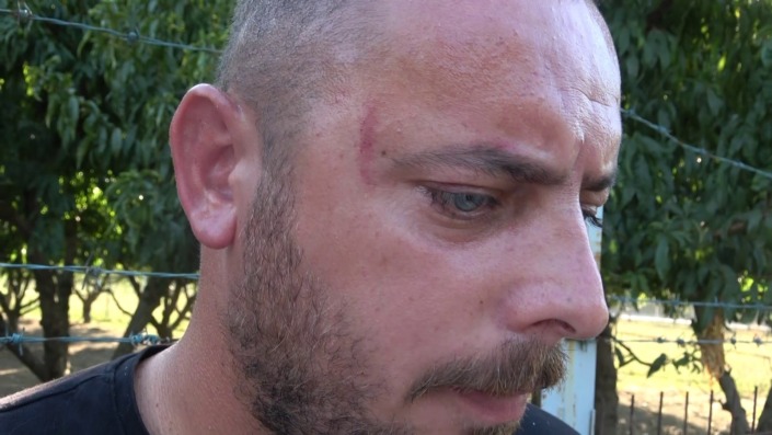 Bursalı çiftçiye “neden enginar vermiyorsun” dayağı…