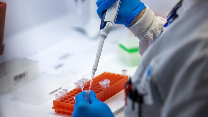 Bulaştığı kişide ölüm oranı yüzde 88’e kadar çıkıyor