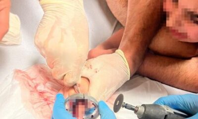 Bursa’da 5 yaşındaki çocuğun parmağı çeşme aynasına sıkıştı