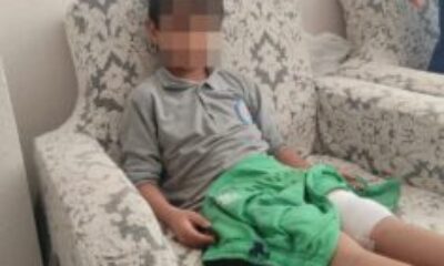 8 yaşındaki çocuğa köpek saldırdı!
