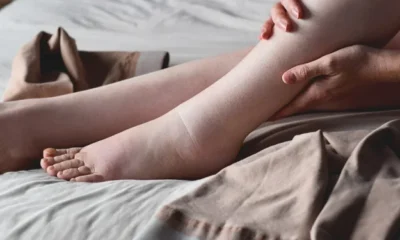 Meme kanserinde tedavi sonrası egzersiz hayati önem taşıyor