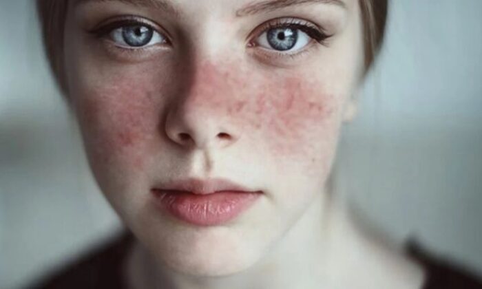 Kadınlarda 9 kat fazla görülüyor!