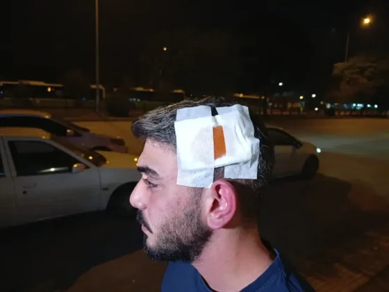 Komşu dehşeti: Dövdü, bıçakladı, dişlerini kırdı!