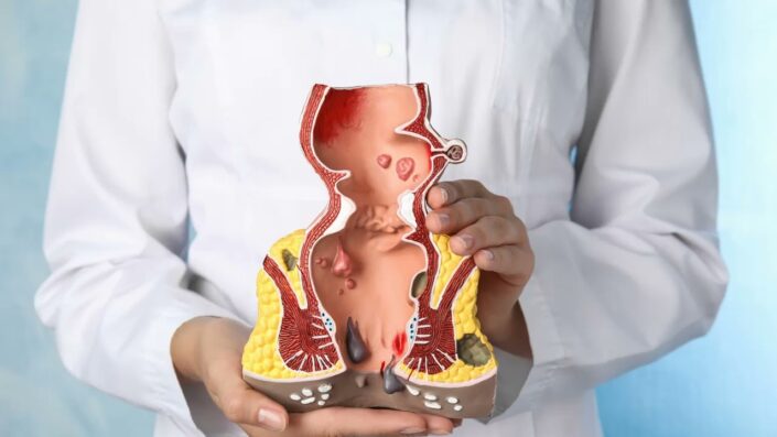 Genel Cerrahi Uzmanı Gökbayır:   “Hemoroidde tedavi yakınmanın düzeyine göre planıyor”