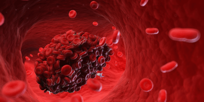 Uzun süreli hareketsizlik büyük risk!