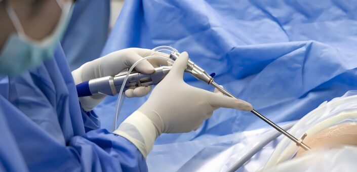 Kapalı cerrahinin avantajları