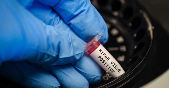 Nipah virüsü uyarısı